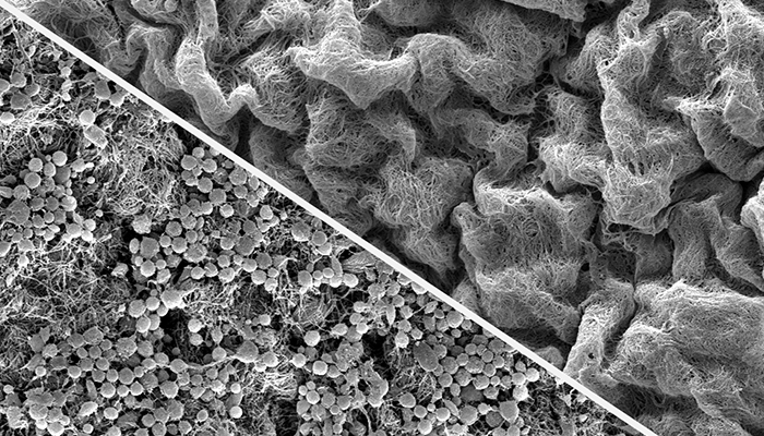 High magnification electron micrograph image courtesy of: A. Zakharchenko, S. Stachelek, C. Nagaswami