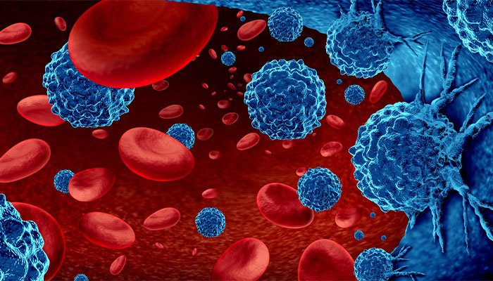 CHOP and Penn researchers have gained insight into how some patients develop resistance to CD20-targeted immunotherapies for certain blood cancers