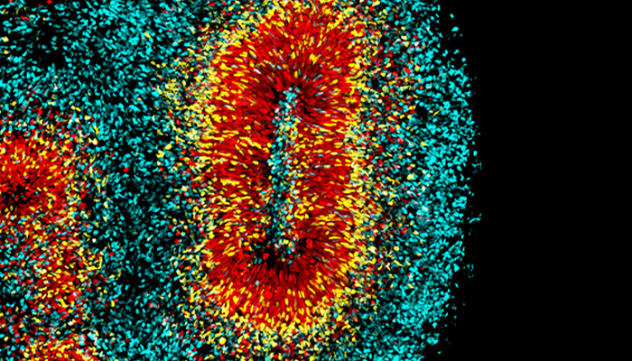 Brain organoids provide an accessible platform to study human cortical development