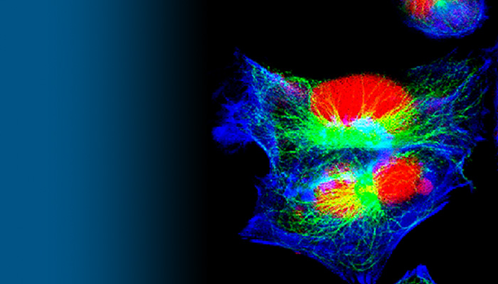 Drug-Diet Combo Reduces Tumor Growth in Neuroblastoma Models